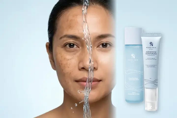 Perbandingan wajah kering berflek hitam vs kulit lembap kenyal merata dengan Paket Adenosine & Toner 150ml Numa Skin