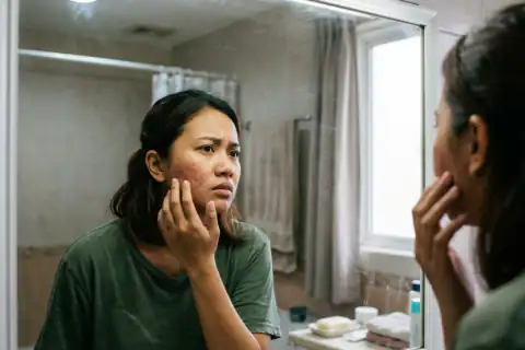 Kulit wajah terasa perih, ketarik, dan memerah selesai mencuci muka dengan sabun keras