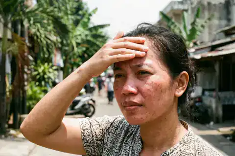 Kulit wajah memerah dan muncul bintik flek hitam akibat terpapar sinar matahari tanpa proteksi UV