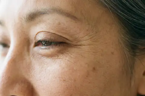 Sunscreen konvensional yang lengket dan membuat kulit tampak kusam berminyak