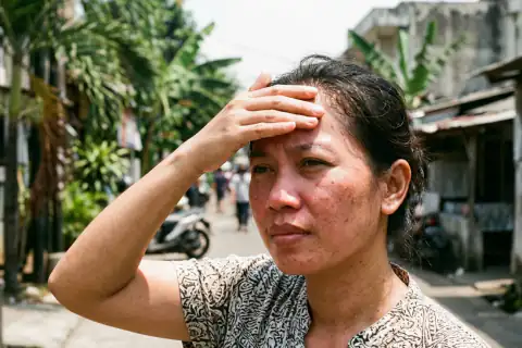 Paparan sinar matahari siang merusak kolagen kulit dan memicu kerutan