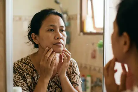 Garis senyum dalam dan kontur pipi menurun akibat penurunan energi sel