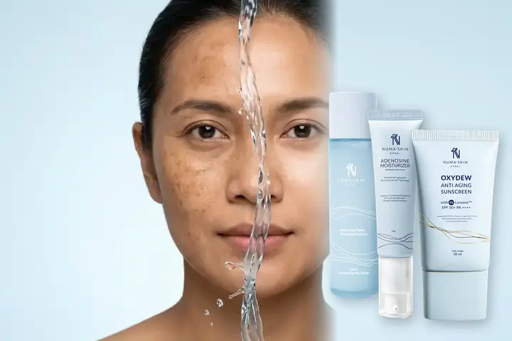 Perbandingan wajah kering berflek vs kulit kenyal terlindungi dengan Paket Sunscreen Adenosine dan Toner 150ml Numa Skin