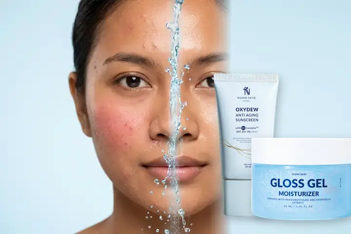 Perbandingan wajah berminyak kemerahan vs kulit kalem terlindungi dengan Paket Sunscreen & Gloss Gel Numa Skin